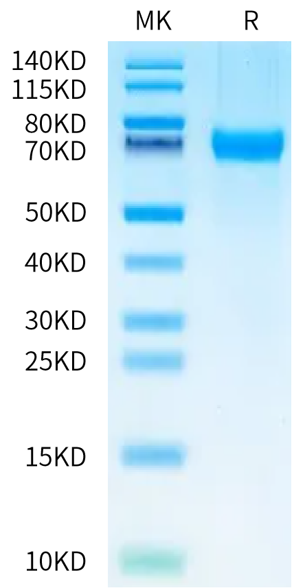 Mouse 4-1BB Ligand on Bis-Tris PAGE under reduced condition. The purity is greater than 95%.Recombinant Mouse 4-1BB Ligand/TNFSF9 Protein, Endotoxin-Free, Active