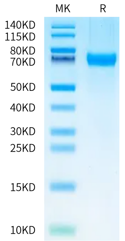Mouse 4-1BB Ligand on Bis-Tris PAGE under reduced condition. The purity is greater than 95%.Recombinant Mouse 4-1BB Ligand/TNFSF9 Protein, Active