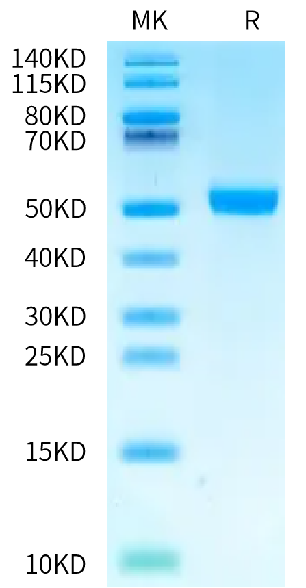 Human CDH17 Domain 7 on Bis-Tris PAGE under reduced condition. The purity is greater than 95%.Recombinant Human CDH17/Cadherin 17 Domain 7 Protein, Endotoxin-Free, Active