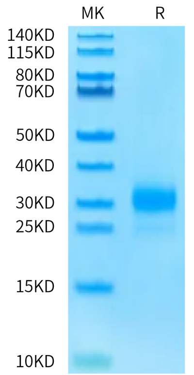 Biotinylated Human CD160 on Bis-Tris PAGE under reduced condition. The purity is greater than 95%.Biotinylated Human CD160 Protein, Active