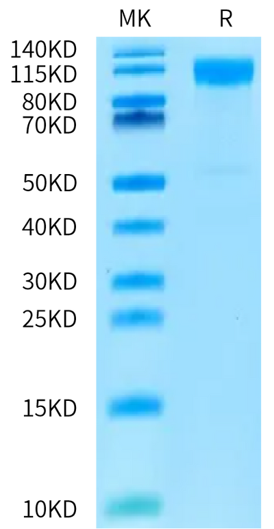 Cynomolgus IL-31 RA on Bis-Tris PAGE under reduced condition. The purity is greater than 95%.Recombinant Cynomolgus IL-31 RA-Protein, Active