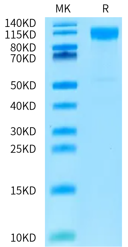 Cynomolgus IL-31 RA on Bis-Tris PAGE under reduced condition. The purity is greater than 95%.Recombinant Cynomolgus IL-31 RA-Protein, Active