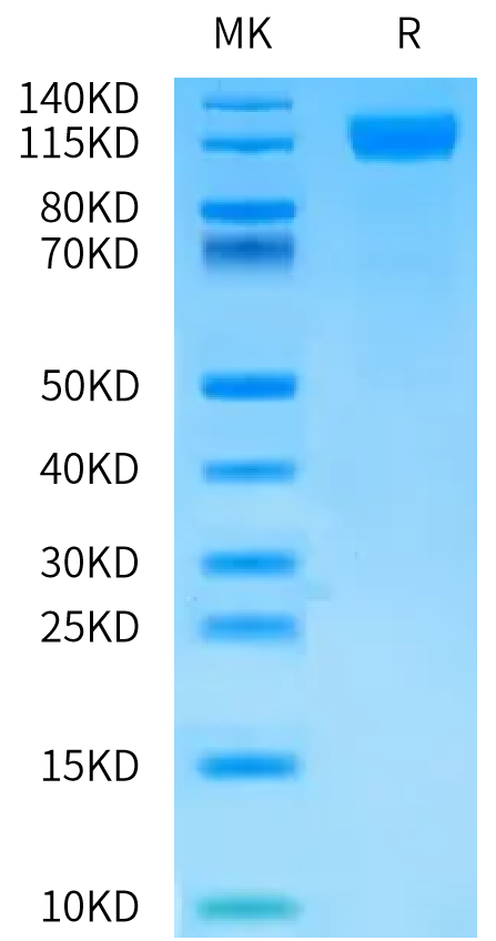 Biotinylated Human OSMR beta on Bis-Tris PAGE under reduced condition. The purity is greater than 95%.Biotinylated Human OSMR beta Protein, Active