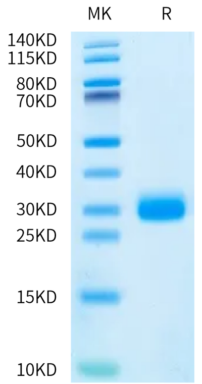 Human PGLYRP1 on Bis-Tris PAGE under reduced condition. The purity is greater than 95%.Recombinant Human PGLYRP1 Protein, Endotoxin-Free, Active