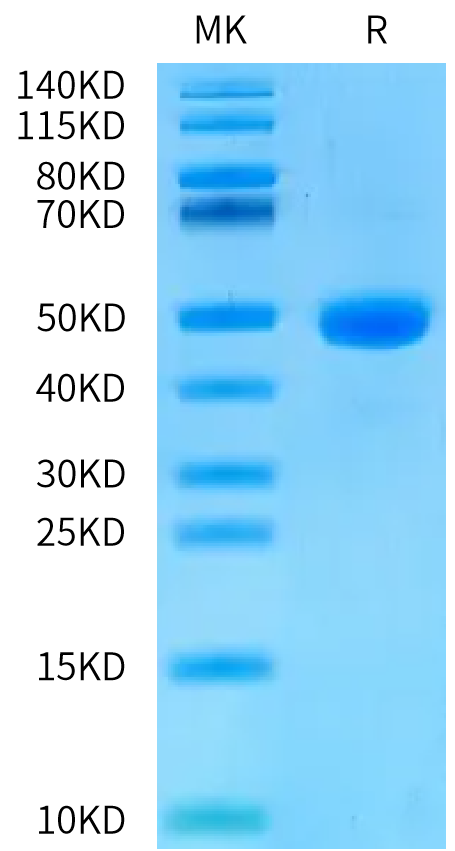 Human CDH17 Domain 6 on Bis-Tris PAGE under reduced condition. The purity is greater than 95%.Recombinant Human CDH17/Cadherin 17 Domain 6 Protein, Active