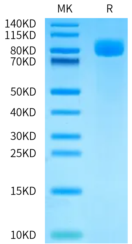 Human Siglec-6 on Bis-Tris PAGE under reduced condition. The purity is greater than 95%.Recombinant Human Siglec-6/CD327 Protein, Active