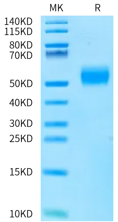Human ALK-7 on Bis-Tris PAGE under reduced condition. The purity is greater than 95%.Recombinant Human ALK-7/Activin RIC Protein, Active