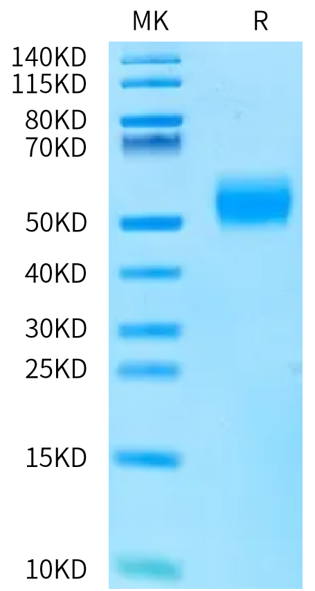 Human ALK-7 on Bis-Tris PAGE under reduced condition. The purity is greater than 95%.Recombinant Human ALK-7/Activin RIC Protein, Active