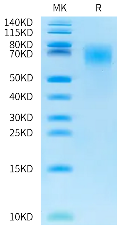 Biotinylated Cynomolgus CEACAM-6 on Bis-Tris PAGE under reduced condition. The purity is greater than 95%.Biotinylated Cynomolgus CEACAM-6/CD66c Protein