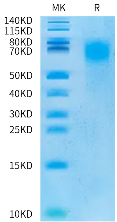 Cynomolgus CEACAM-6 on Bis-Tris PAGE under reduced condition. The purity is greater than 95%.Recombinant Cynomolgus CEACAM-6/CD66c Protein, Endotoxin-Free