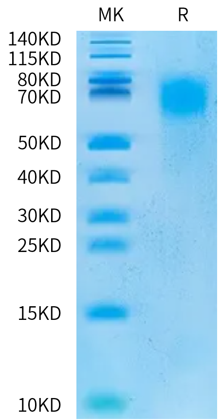 Cynomolgus CEACAM-6 on Bis-Tris PAGE under reduced condition. The purity is greater than 95%.Recombinant Cynomolgus CEACAM-6/CD66c Protein