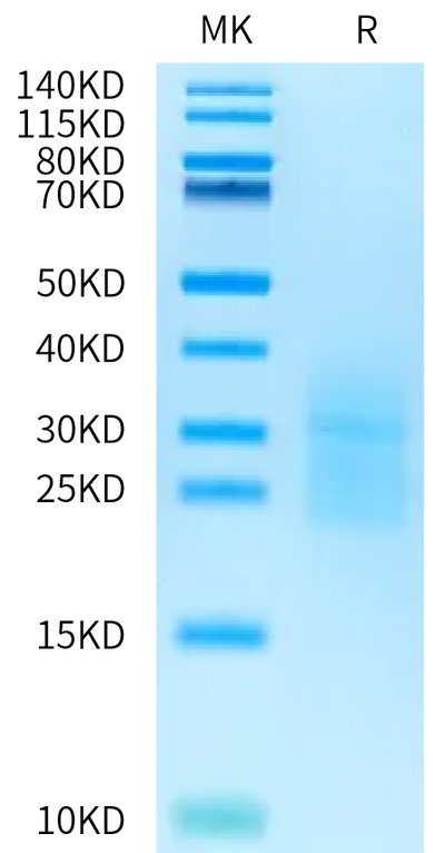 Cynomolgus ALK-7 on Bis-Tris PAGE under reduced condition. The purity is greater than 95%.Recombinant Cynomolgus ALK-7/Activin RIC Protein, Active