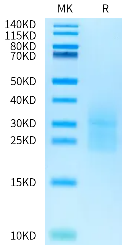 Cynomolgus ALK-7 on Bis-Tris PAGE under reduced condition. The purity is greater than 95%.Recombinant Cynomolgus ALK-7/Activin RIC Protein, Active