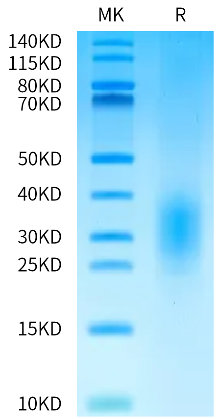 Biotinylated Human ALK-7 on Bis-Tris PAGE under reduced condition. The purity is greater than 95%.Biotinylated Human ALK-7/Activin RIC Protein, Active