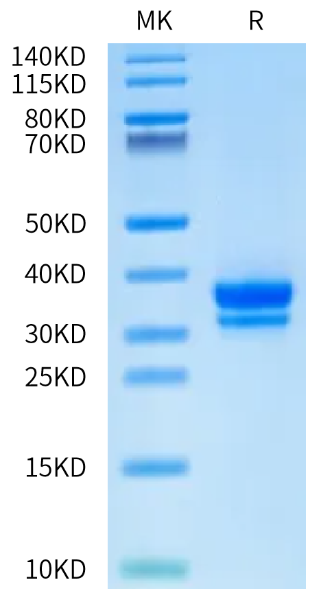 Mouse HMGB1 on Bis-Tris PAGE under reduced condition. The purity is greater than 95%.Recombinant Mouse HMGB1 Protein