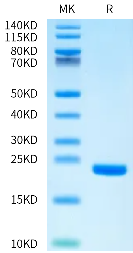 Biotinylated Human FGF1 on Bis-Tris PAGE under reduced condition. The purity is greater than 95%.Biotinylated Human FGF1 Protein, Active