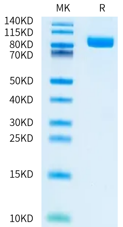 Human EGFRVIII on Bis-Tris PAGE under reduced condition. The purity is greater than 95%.Recombinant Human EGFRVIII Protein, Active