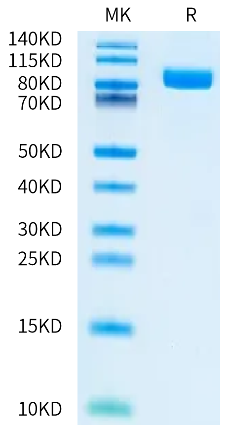 Human EGFRVIII on Bis-Tris PAGE under reduced condition. The purity is greater than 95%.Recombinant Human EGFRVIII Protein, Active