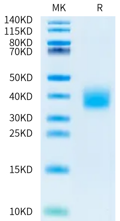 Sus scrofa IL-22 on Bis-Tris PAGE under reduced condition. The purity is greater than 95%.Recombinant Sus scrofa IL-22 Protein, Endotoxin-Free, Active
