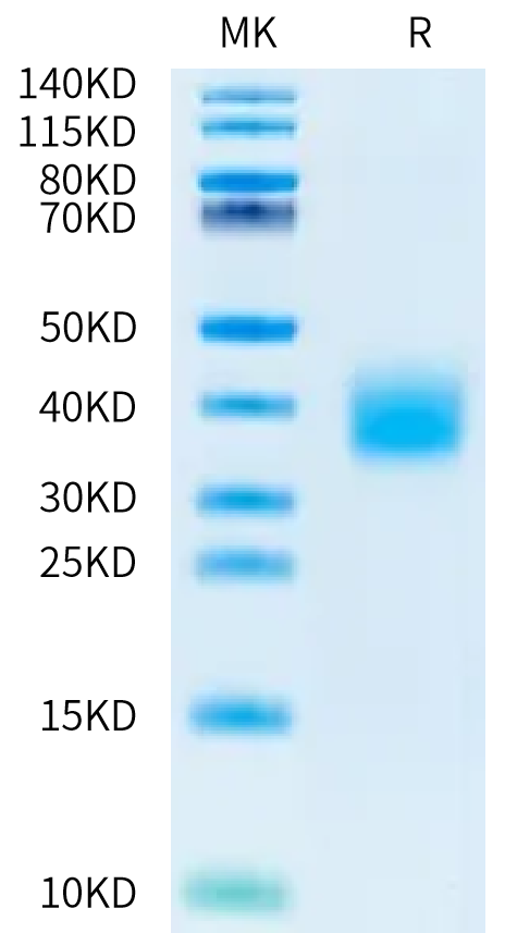Sus scrofa IL-22 on Bis-Tris PAGE under reduced condition. The purity is greater than 95%.Recombinant Sus scrofa IL-22 Protein, Endotoxin-Free, Active