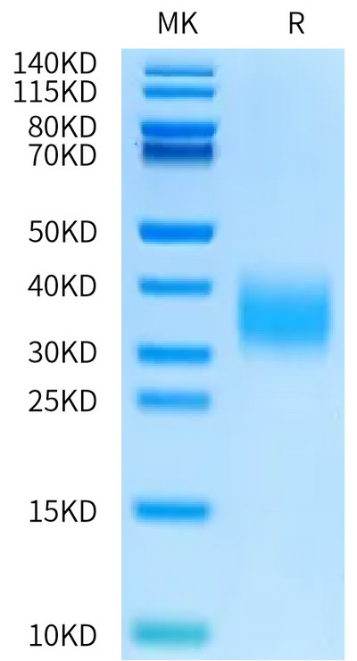 Rat IL-22 on Bis-Tris PAGE under reduced condition. The purity is greater than 95%.Recombinant Rat IL-22 Protein, Endotoxin-Free, Active