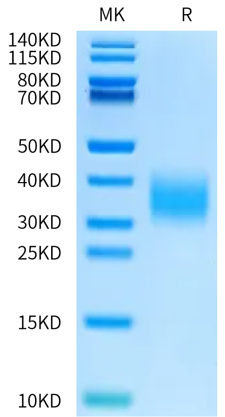 Rat IL-22 on Bis-Tris PAGE under reduced condition. The purity is greater than 95%.Recombinant Rat IL-22 Protein, Endotoxin-Free, Active