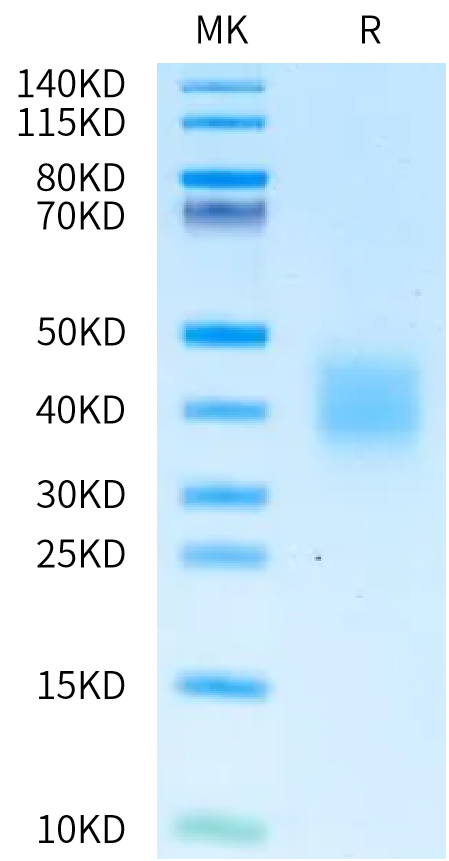 Oryctolagus cuniculus IL-22 on Bis-Tris PAGE under reduced condition. The purity is greater than 95%.Recombinant Oryctolagus cuniculus IL-22 Protein, Endotoxin-Free, Active
