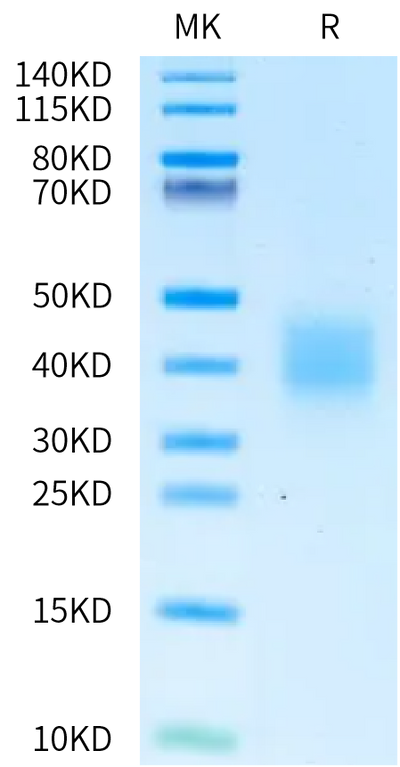 Oryctolagus cuniculus IL-22 on Bis-Tris PAGE under reduced condition. The purity is greater than 95%.Recombinant Oryctolagus cuniculus IL-22 Protein, Active