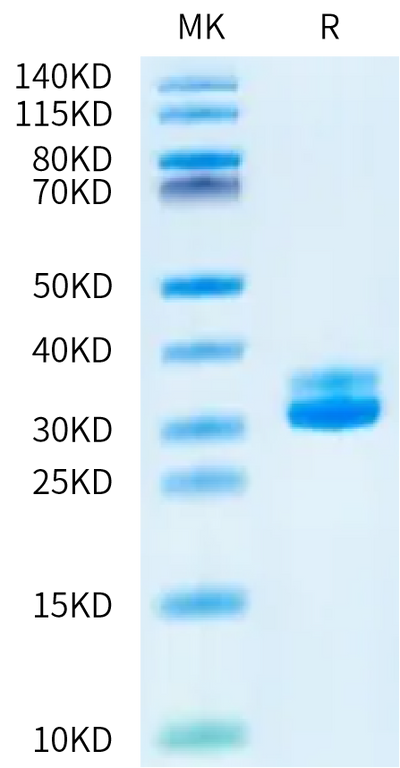 Human Kallikrein 7 on Bis-Tris PAGE under reduced condition. The purity is greater than 95%.Recombinant Human Kallikrein 7/KLK7 Protein, Active