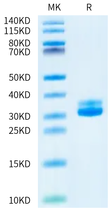 Human Kallikrein 7 on Bis-Tris PAGE under reduced condition. The purity is greater than 95%.Recombinant Human Kallikrein 7/KLK7 Protein, Active