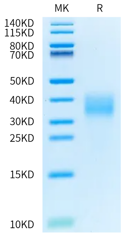 Canine IL-22 on Bis-Tris PAGE under reduced condition. The purity is greater than 95%.Recombinant Canine IL-22 Protein, Endotoxin-Free, Active
