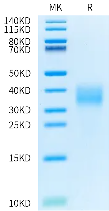 Canine IL-22 on Bis-Tris PAGE under reduced condition. The purity is greater than 95%.Recombinant Canine IL-22 Protein, Active