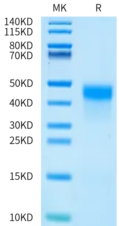 Human Kallikrein 5 on Bis-Tris PAGE under reduced condition. The purity is greater than 95%.Recombinant Human Kallikrein 5/KLK5 Protein, Active