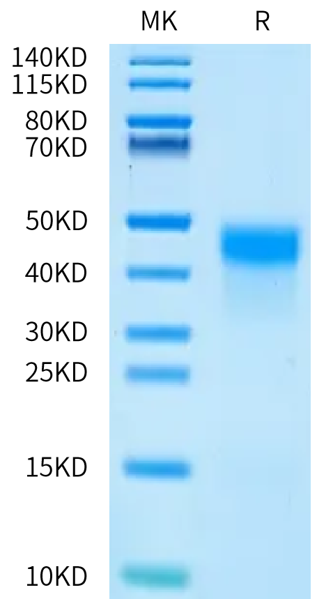 Human Kallikrein 5 on Bis-Tris PAGE under reduced condition. The purity is greater than 95%.Recombinant Human Kallikrein 5/KLK5 Protein, Active