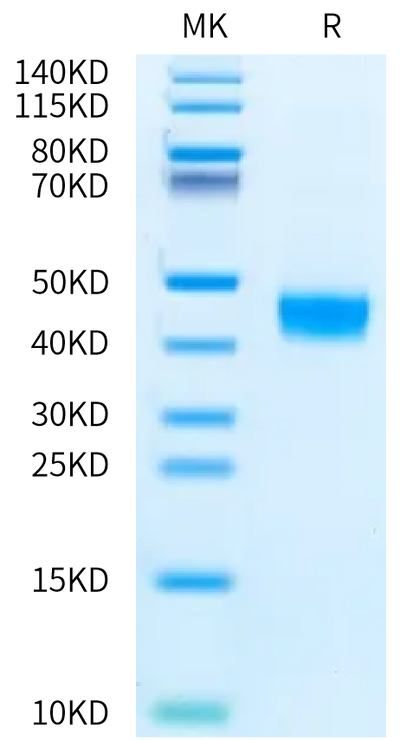 Human MMP-14 on Bis-Tris PAGE under reduced condition. The purity is greater than 95%.Recombinant Human MMP-14 Protein
