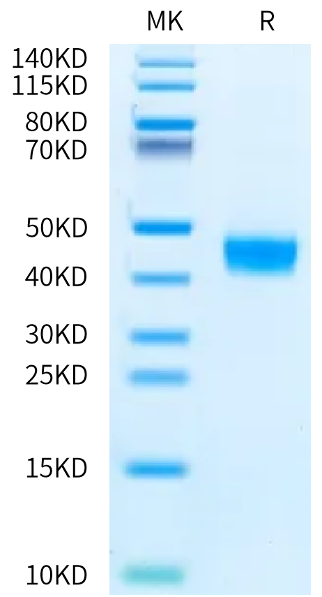 Human MMP-14 on Bis-Tris PAGE under reduced condition. The purity is greater than 95%.Recombinant Human MMP-14 Protein