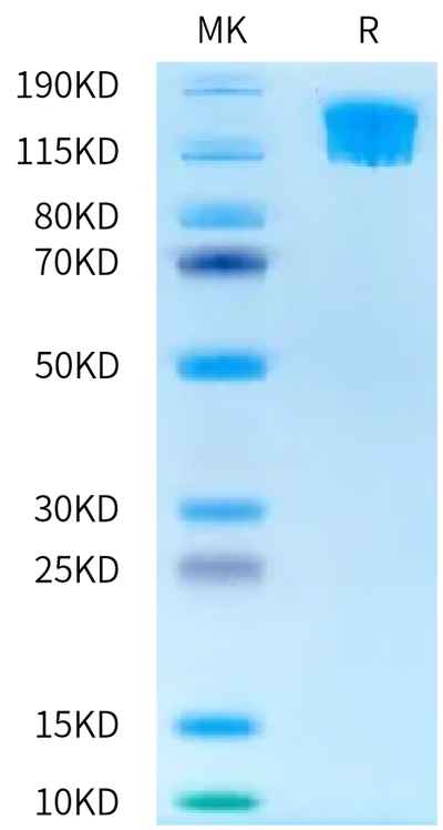 Biotinylated Human SEZ6L2 on Bis-Tris PAGE under reduced condition. The purity is greater than 95%.Biotinylated Human SEZ6L2 Protein