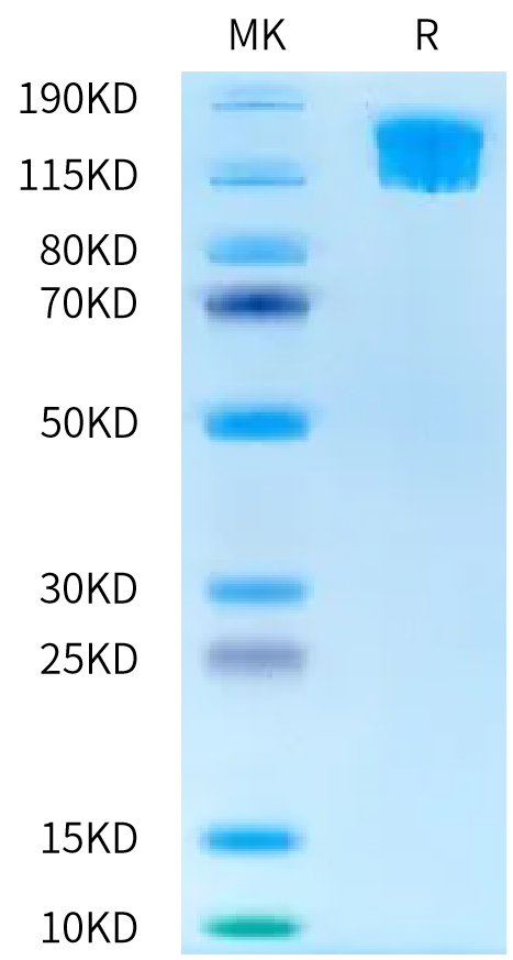 Biotinylated Human SEZ6L2 on Bis-Tris PAGE under reduced condition. The purity is greater than 95%.Biotinylated Human SEZ6L2 Protein