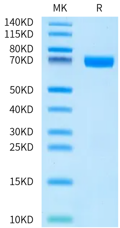 Human TNFSF15 (R32A, R85A) Trimer on Bis-Tris PAGE under reduced condition. The purity is greater than 95%.Recombinant Human TNFSF15 (R32A, R85A) Trimer Protein, Active