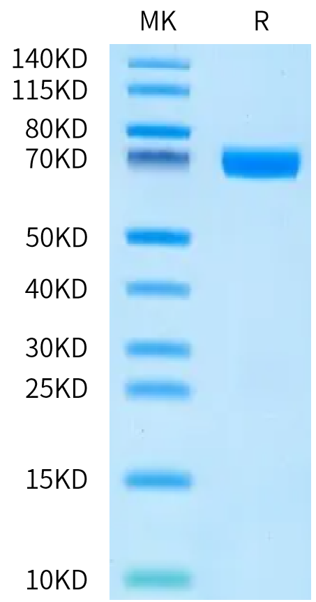 Human TNFSF15 (R32A, R85A) Trimer on Bis-Tris PAGE under reduced condition. The purity is greater than 95%.Recombinant Human TNFSF15 (R32A, R85A) Trimer Protein, Active
