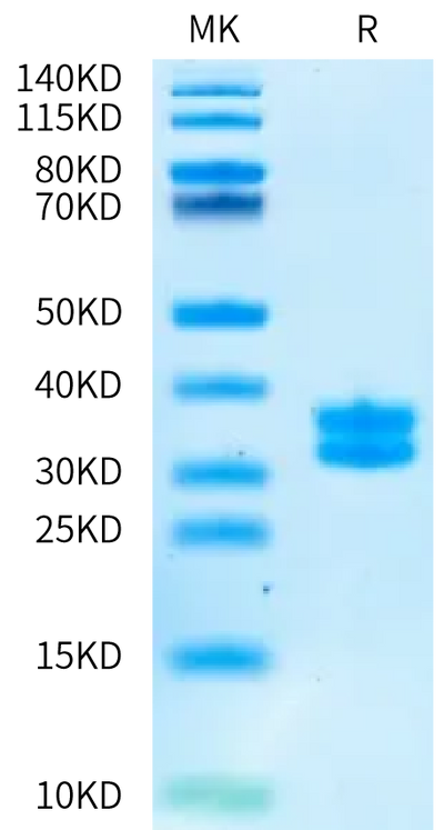 Biotinylated Human Kallikrein 7 on Bis-Tris PAGE under reduced condition. The purity is greater than 95%.Biotinylated Human Kallikrein 7/KLK7 Protein, Active