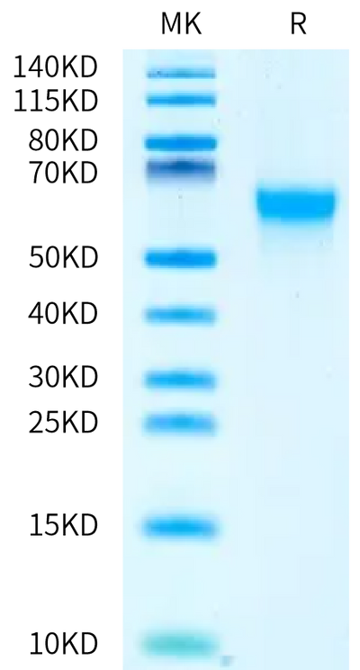 Cynomolgus MADCAM1 on Bis-Tris PAGE under reduced condition. The purity is greater than 95%.Recombinant Cynomolgus MADCAM1 Protein, Active