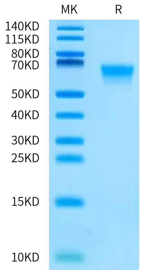Biotinylated Cynomolgus MADCAM1 on Bis-Tris PAGE under reduced condition. The purity is greater than 95%.Biotinylated Cynomolgus MADCAM1 Protein, Active