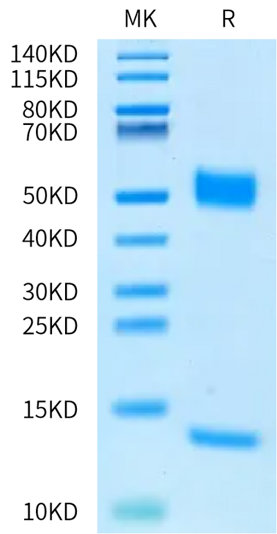 Biotinylated Rat FcRn on Bis-Tris PAGE under reduced condition. The purity is greater than 95%.Biotinylated Rat FcRn Protein, Active
