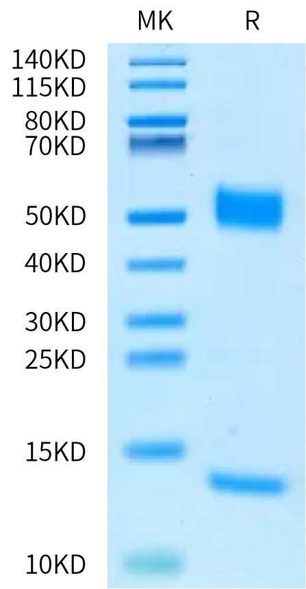Biotinylated Rat FcRn on Bis-Tris PAGE under reduced condition. The purity is greater than 95%.Biotinylated Rat FcRn Protein, Active