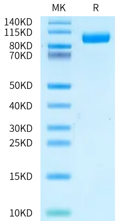 Biotinylated Human IL-23R on Bis-Tris PAGE under reduced condition. The purity is greater than 95%.Biotinylated Human IL-23R Protein, Active