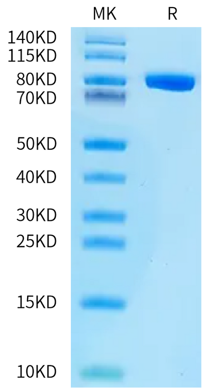 Biotinylated Human CD228 on Bis-Tris PAGE under reduced condition. The purity is greater than 95%.Biotinylated Human CD228/MFI2 Protein, Active