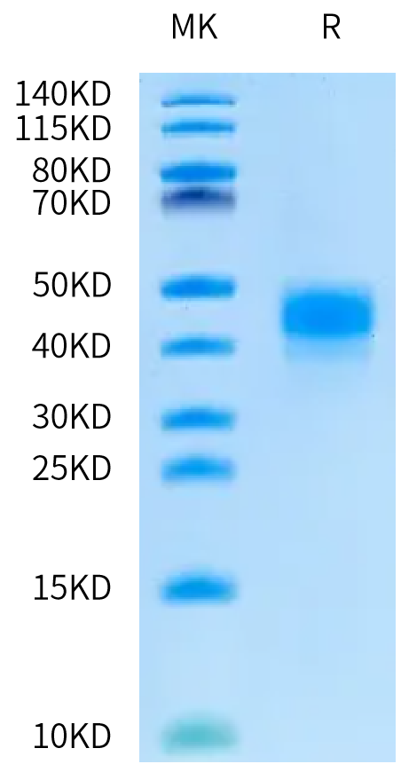 Biotinylated Human Kallikrein 5 on Bis-Tris PAGE under reduced condition. The purity is greater than 95%.Biotinylated Human Kallikrein 5/KLK5 Protein, Active