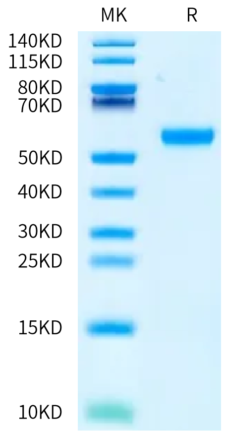 FITC-Labeled Human CD5 on Bis-Tris PAGE under reduced condition. The purity is greater than 95%.Recombinant FITC-Labeled Human CD5 Protein, Active