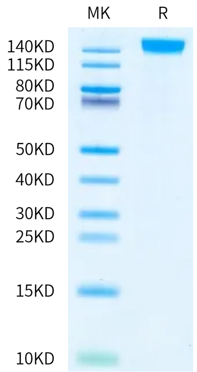 Human SEZ6L on Bis-Tris PAGE under reduced condition. The purity is greater than 95%.Recombinant Human SEZ6L Protein